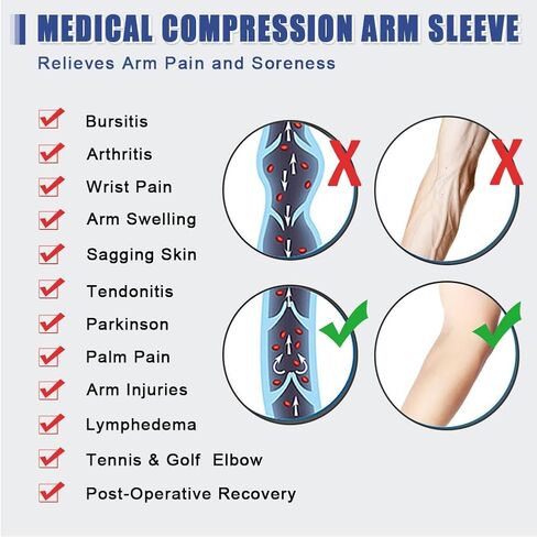 beister Lymphedema Medical Compression Arm Sleeve with Gauntlet for Men & Women (Single), 20-30 mmHg Full Arm Support with Dot Silicone Band, Graduated Compression Arm Brace for Swelling, Arthritis in Saudi Arabia