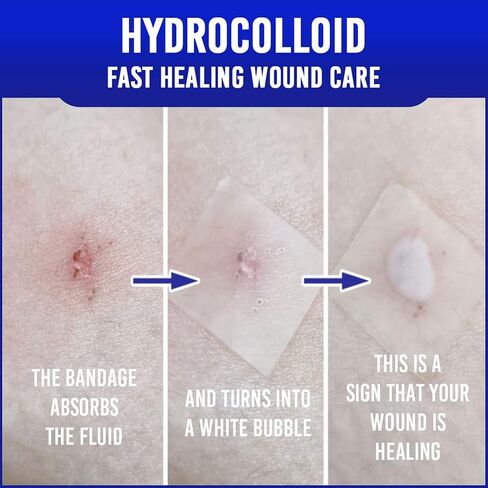 Hydrocolloid Transparent Cuttable Adhesive Bandage (4 x 4 inch) x 10 - Extra Large Korean Wound Cover Stretch Dressing Waterproof Bandages Fast Healing Wound Care First Aid Bandaid Patch in Saudi Arabia