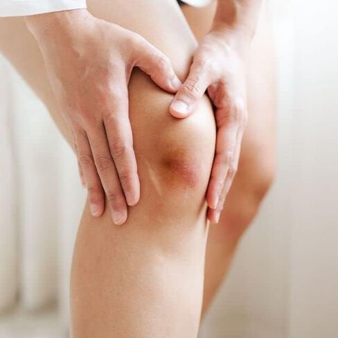 كريم الكدمات - 30 جم - تركيبة شفاء متقدمة مثبتة سريريًا مع الجلسرين والمنثول للوقاية من الكدمات - جل بلسم طبيعي عالي القوة مضاد للكدمات للشفاء in Saudi Arabia