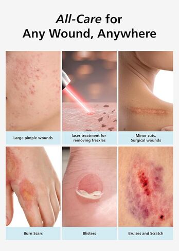 Easyderm ضمادات غرواني مائي رفيعة للجروح الكبيرة مقاس 10.16 سم × 10.16 سم 3 عبوات (6 ضمادات) | ضمادة مقاومة للماء وخالية من اللاتكس وعالية الامتصاص للحروق والبثور والعناية بحب الشباب وشفاء الجروح باستخدام مقص صغير in Kuwait