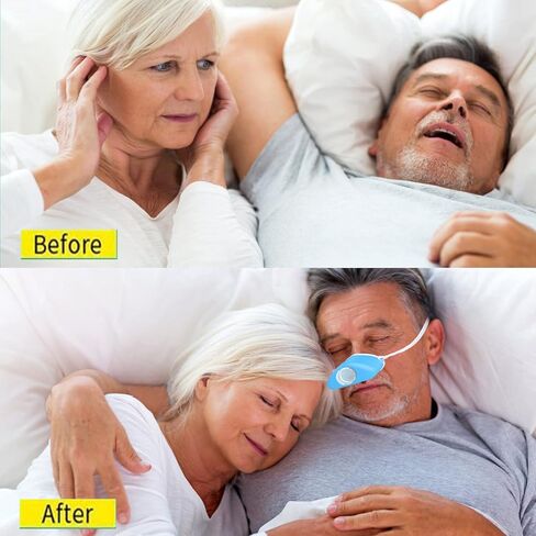 4 in 1 Anti snoring Devices,2024 New Atomization snoring Solution,Right Amount Fog,Adjustable Wind Force Sleep Apnea Devices for Comfortable Sleep (Size Adjustment) in Kuwait