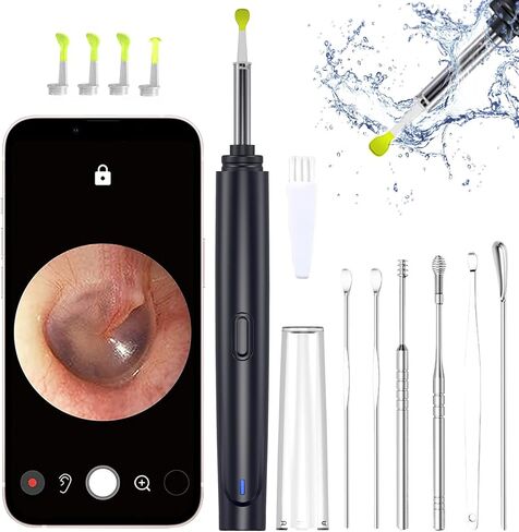 Ear Wax Removal Tool, Smart Visual Ear Cleaner, 1080P FHD Wireless Ear Otoscope with 6 LED Lights, 5 Ear Spoon & 8 Traditional Tools, IP67 Waterproof WiFi Ear Camera for iPhone, iPad & Android (Black) in Saudi Arabia