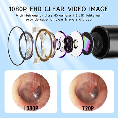 Ear Wax Removal Tool, Smart Visual Ear Cleaner, 1080P FHD Wireless Ear Otoscope with 6 LED Lights, 5 Ear Spoon & 8 Traditional Tools, IP67 Waterproof WiFi Ear Camera for iPhone, iPad & Android (Black) in Saudi Arabia