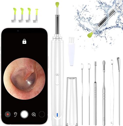 Ear Wax Removal Tool, Smart Visual Ear Cleaner, 1080P FHD Wireless Ear Otoscope with 6 LED Lights, 5 Ear Spoon & 8 Traditional Tools, IP67 Waterproof WiFi Ear Camera for iPhone, iPad & Android (Black) in Saudi Arabia