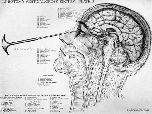Lobotomy Tools Orbitoclast and Hammer Medical Surgical Frontal Lobotomy Instruments Oddity Curiosity in Saudi Arabia