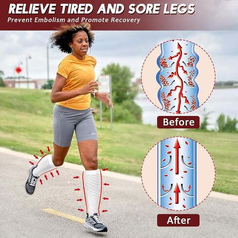 جوارب Ailaka عالية الضغط للركبة للرجال والنساء، 20-30 مم زئبقي، دعم متدرج ثابت، جوارب الدوالي مفتوحة عند الأصابع للسفر والطيران والحمل والتعافي in Kuwait