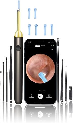 إزالة شمع الأذن، منظف الأذن مع الكاميرا، أداة إزالة شمع الأذن 1080 بكسل مع ضوء، مجموعة إزالة شمع الأذن مع 8 قطع للأذن، طقم تنظيف الأذن لنظام iOS، والهواتف الذكية أندرويد (أسود) in Kuwait