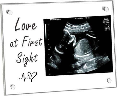 إطار صورة بالموجات فوق الصوتية من الأكريليك، هدايا للأم الجديدة، إطار صور بالموجات فوق الصوتية لديكور الحضانة، علامة إعلان الطفل، هدايا الحمل لأب الأم لأول مرة، حفل استقبال المولود الجديد يكشف عن الجنس هدايا الحب من النظرة الأولى in Kuwait