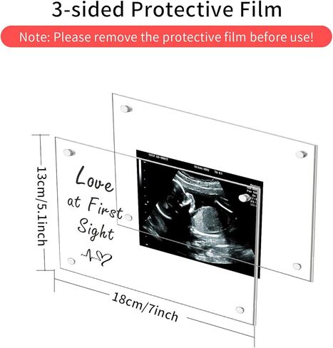 إطار صورة بالموجات فوق الصوتية من الأكريليك، هدايا للأم الجديدة، إطار صور بالموجات فوق الصوتية لديكور الحضانة، علامة إعلان الطفل، هدايا الحمل لأب الأم لأول مرة، حفل استقبال المولود الجديد يكشف عن الجنس هدايا الحب من النظرة الأولى in Kuwait