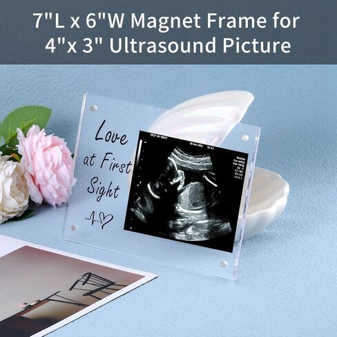 إطار صورة بالموجات فوق الصوتية من الأكريليك، هدايا للأم الجديدة، إطار صور بالموجات فوق الصوتية لديكور الحضانة، علامة إعلان الطفل، هدايا الحمل لأب الأم لأول مرة، حفل استقبال المولود الجديد يكشف عن الجنس هدايا الحب من النظرة الأولى in Kuwait