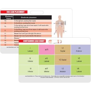 STEMI 12 Lead Reference and 12 Lead EKG (ECG) Placement Reference Horizontal Badge Card - Excellent Resource for Nurses, EKG Techs, EMT, Cardiology Tech, or Other Healthcare Professionals