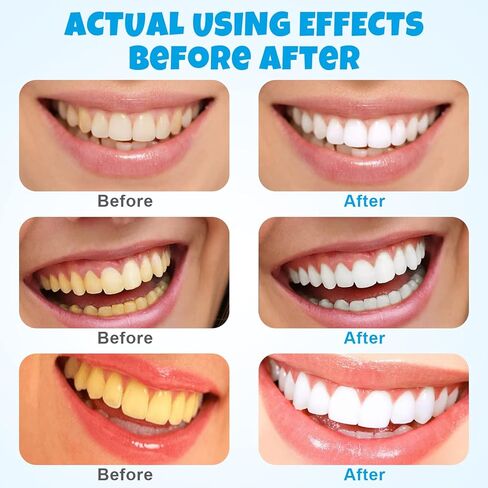 (50ML*2 PCS) Mouthwash Foam,Teeth Mouthwash Whitening Toothpaste Foam,Ultra-fine Mousse Foam Whitening Products,Deep Cleaning Toothpaste,Teeth Whitening Foam for White Teeth & Fresh Breath in Kuwait