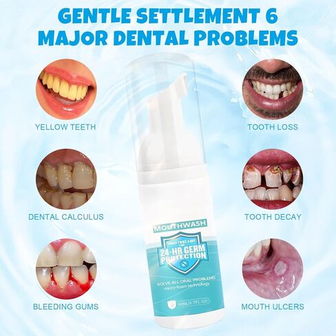 (50ML*2 PCS) Mouthwash Foam,Teeth Mouthwash Whitening Toothpaste Foam,Ultra-fine Mousse Foam Whitening Products,Deep Cleaning Toothpaste,Teeth Whitening Foam for White Teeth & Fresh Breath in Kuwait