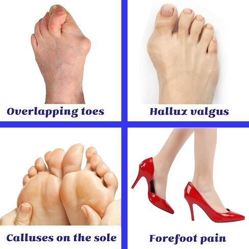 Metatarsal Pads, Gel Toe Separators & Ball of Foot Cushions – Soft & Breathable, Ideal for Blisters, Morton's Neuroma, Diabetic Feet, Bunion Pain Relief (6) in Saudi Arabia