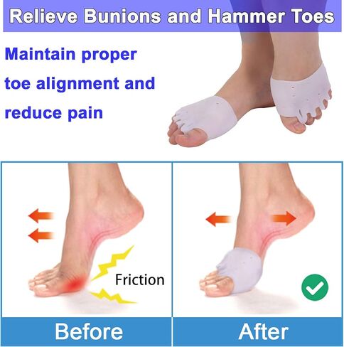 Metatarsal Pads, Gel Toe Separators & Ball of Foot Cushions – Soft & Breathable, Ideal for Blisters, Morton's Neuroma, Diabetic Feet, Bunion Pain Relief (6) in Saudi Arabia