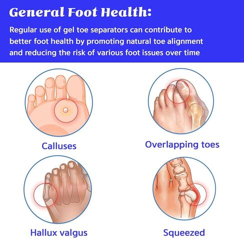 Metatarsal Pads, Gel Toe Separators & Ball of Foot Cushions – Soft & Breathable, Ideal for Blisters, Morton's Neuroma, Diabetic Feet, Bunion Pain Relief (6) in Saudi Arabia