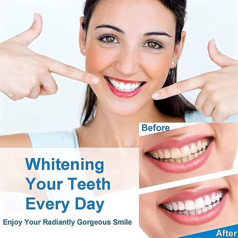 Niacinamide Toothpaste,Bodyaccel Toothpaste,Body Accel Niacinamide Whitening Toothpaste,Fresh Breath Toothpaste（1pcs） in Saudi Arabia