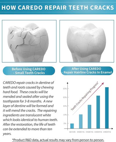 Healing Teeth Crack Toothpaste, The ONLY Toothpaste Repairing Cracked Teeth Enamel Cracks, Cure Tooth Sensitivity, Remove Pigment in Crack 100g 2 Counts As Mother's day Gift in Saudi Arabia