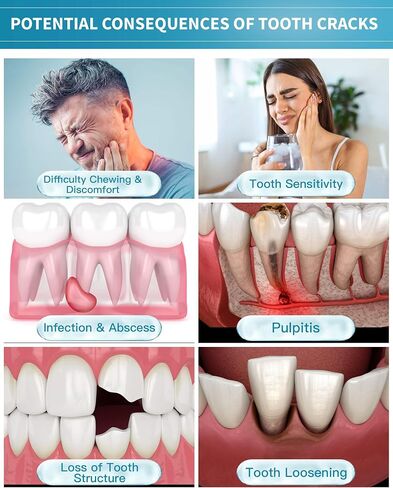 Healing Teeth Crack Toothpaste, The ONLY Toothpaste Repairing Cracked Teeth Enamel Cracks, Cure Tooth Sensitivity, Remove Pigment in Crack 100g 2 Counts As Mother's day Gift in Saudi Arabia