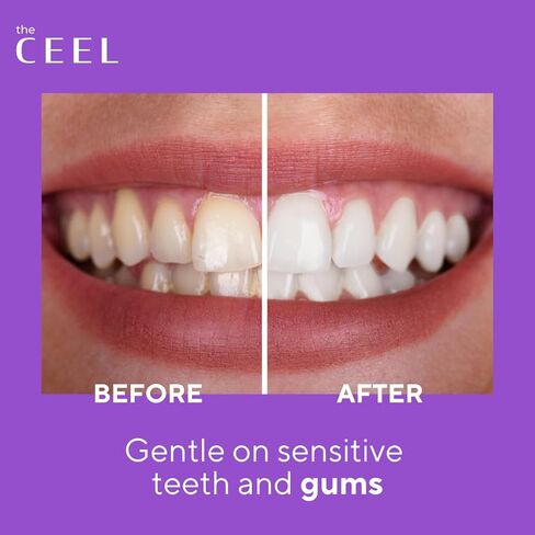 Purple Toothpaste for Teeth Whitening with Purple Carbon | Purple Toothpaste for Teeth Whitening | Color Corrector Purple Toothpaste with Mint Flavour | 75 GR… in Saudi Arabia