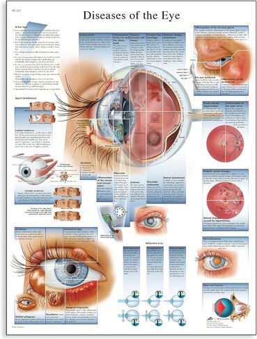 3B Scientific VR1231L Glossy Laminated Paper Diseases of The Eye Anatomical Chart, Poster Size 20" Width x 26" Height in Saudi Arabia