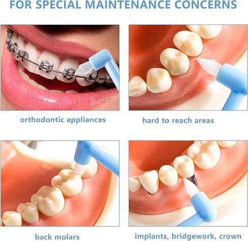 6 Pcs Tufted Toothbrush Interspace Brush End-tuft Tapered Toothbrush Soft Trim Toothbrush Wisdom Gap Toothbrush for Orthodontic Braces Bridges Line and Detail Cleaning in Kuwait