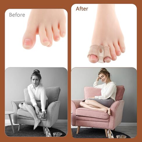 2Pcs Toe Spacers, Silicone Toe Separators, Bunion Toe Separators for Overlapping Toes, Plantar Fasciitis, Bunions for Women and Men in Saudi Arabia