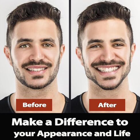 جهاز تمرين الفك للرجال والنساء، جهاز تدريب الفك من السيليكون، مقوي قوي لمدرب الفك مع 4 مستويات مقاومة، أقراص تونر الفك من السيليكون لتشكيل الوجه والرقبة، أزرق in Kuwait