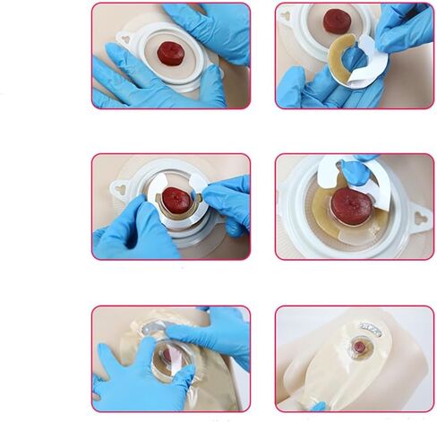 20PCS Ostomy Supplies 4mm Thick Ostomy Barrier Rings in Saudi Arabia