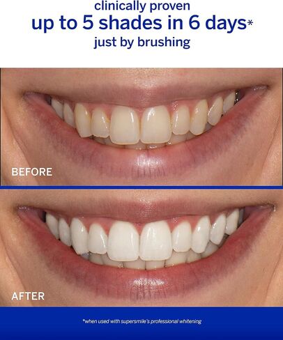 Supersmile Professional Awake Whitening Toothpaste for your Morning Routine - Clinically Proven to Whiten Teeth Up to 6 Shades (Zesty Mint, 4.2 Oz) in Saudi Arabia