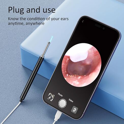 Otoscope with Light for iPhone iPad - Ultra Clear View Ear Scope Otoscope with Light | 3.5mm Otoscope Camera with Ear Wax Removal Tools | Ear Otoscope Supports Photo Capture & Video Recording in Kuwait
