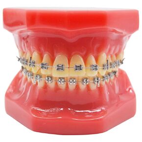 Dental Orthodontic Metal Brcket with Typodont Teeth Model