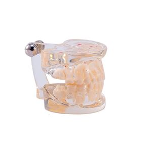 Dental Pathology Model Pediatric Teeth Model Clear Mixed Age Kids Disease Tooth Model