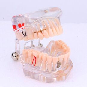 WALFRONT Transparent Dental Study Teaching Teeth Model Adult Typodont Model Assort Teeth Gums Tooth Care Teaching Study Standard Typodont Model Removable Tooth, Poster/Model