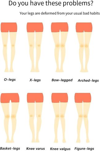 O/X Leg Correction Belt, 3 Sets Leg Corrector Bandage, Adjustable Leg Posture Correction Belt, Bow Leg Straightener Strap, Inside Eight Character Corrector Leggings Belt, Knock Knee Braces (XXL) in Saudi Arabia