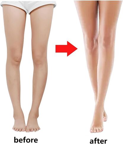 O/X Leg Correction Belt, 3 Sets Leg Corrector Bandage, Adjustable Leg Posture Correction Belt, Bow Leg Straightener Strap, Inside Eight Character Corrector Leggings Belt, Knock Knee Braces (XXL) in Saudi Arabia