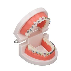 Dental Typodont Teeth Model with Metal Bracket, model fake braces for teeth dental pathological Study for Dentist