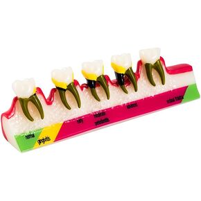 نموذج طب الأسنان Typodont لنموذج دراسة تدريس أمراض اللثة لتعليم المرضى (M8) in Kuwait