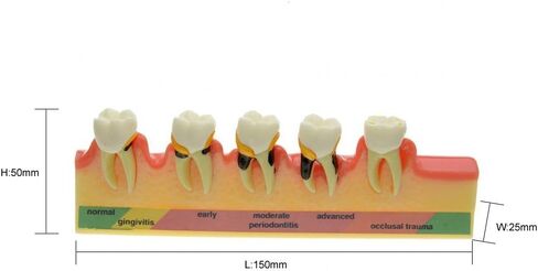 نموذج طب الأسنان Typodont لنموذج دراسة تدريس أمراض اللثة لتعليم المرضى (M8) in Kuwait