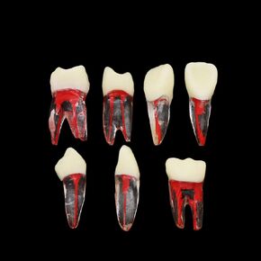 7Pcs Teeth Root Canal Model Endodontic File RCT Practice Pulp for Teaching Study