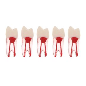 5Pcs Dental Root Canal Pulp Cavity Teeth Model Endodontic Practice RCT Typodont M8007 11# 14# 16# 21# 33# 34# 35# 36# 44# 45# Practicing Study Teach (5Pcs-M8007-14#)