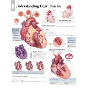 Understanding Heart Disease chart: Wall Chart