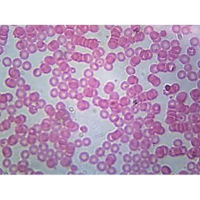 GSC S99031, Human Blood Smear Prepared Microscope Slide, H&E Stain, Pack of 10