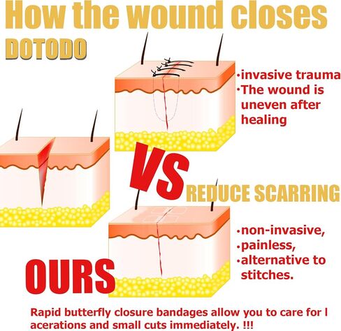 Emergency Wound Closure Strips - HSA/FSA Eligible - Dotodo 2PCS Laceration Closure Kit - Elastic Skin Closure Device | Repair Wounds Without Stitches | Stretchable & Shrinks Back to Close The Cut in Saudi Arabia