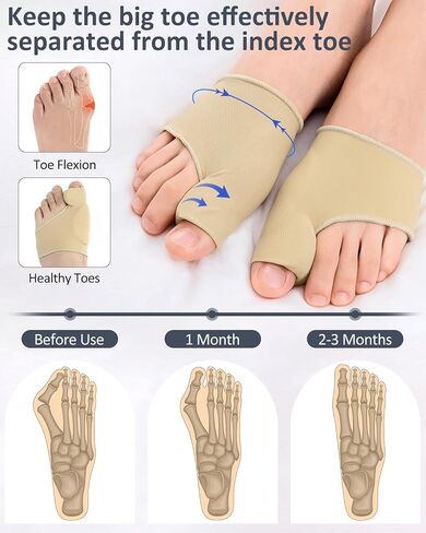 2 Pcs Bunion Corrector for Women Men Bunion Pain Relief, Big Toe Straighteners, Breathable Bunion Correction Socks with Built-in Gel Pad, Big Toe Spacer Separators (Beige) in Saudi Arabia