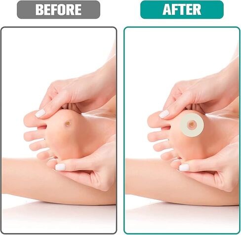 Corn Cushion Pads, 60 PCS Soft Felt Callus Cushions, Self-Adhesive Corn Callus Remover Cushions Toe Heel Pain Relief Anti-wear Sticker Pads for Women Men Protect Calluses from Rubbing on Shoes (Oval) in Saudi Arabia