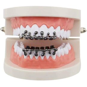 Gold Teardrop Bottom Grillz 6 Teeth Caps Top and Bottom Set Teeth Drip Cap Grillz
