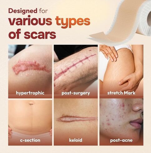 Silicone Scar Tape Reusable Sheets (60" x 1.6") Medical Grade Silicone Scar Sheets for Surgical Scars, Burns, Tummy Tuck, Keloid, C-Section - Cut to Size Scar Treatment in Saudi Arabia