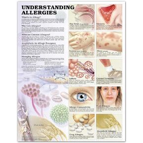 Understanding Allergies Anatomical Chart