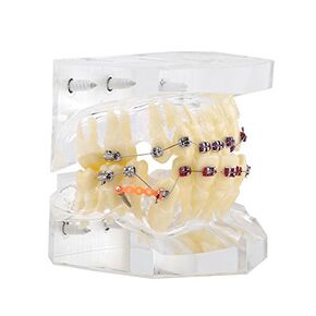 Teeth Educational Model Dental Orthodontic Treatment Malocclusion Study Demonstration Teeth Model with Wire Chain Orange